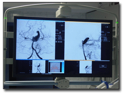 RGB Spectrum Supports Interventional Neuroradiology in Ankara Hacettepe Hospital