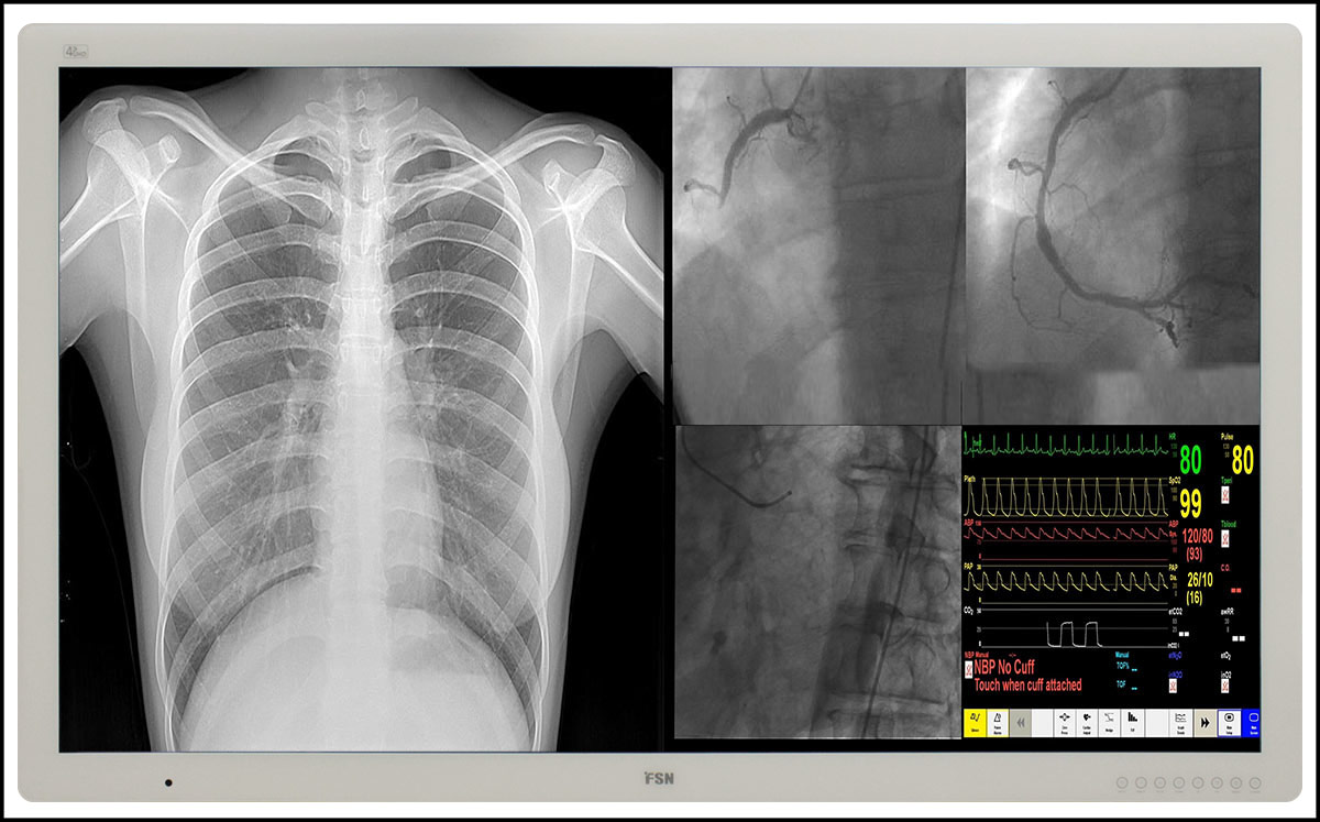 FSN Medical and RGB Spectrum Team Up to Deliver Leading-Edge Medical Audio-Visual Solutions
