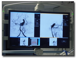 RGB Spectrum Supports Interventional Neuroradiology in Ankara Hacettepe Hospital