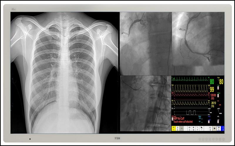 FSN Medical and RGB Spectrum Team Up to Deliver Leading-Edge Medical Audio-Visual Solutions