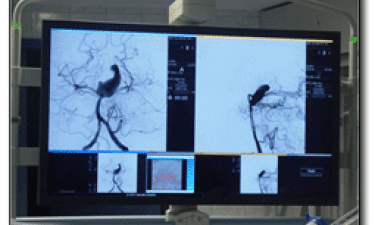RGB Spectrum Supports Interventional Neuroradiology in Ankara Hacettepe Hospital