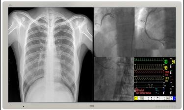 FSN Medical and RGB Spectrum Team Up to Deliver Leading-Edge Medical Audio-Visual Solutions